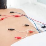paciente recibiendo tratamiento electropuncion seca
