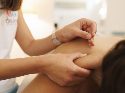 puncion-seca puncion-seca